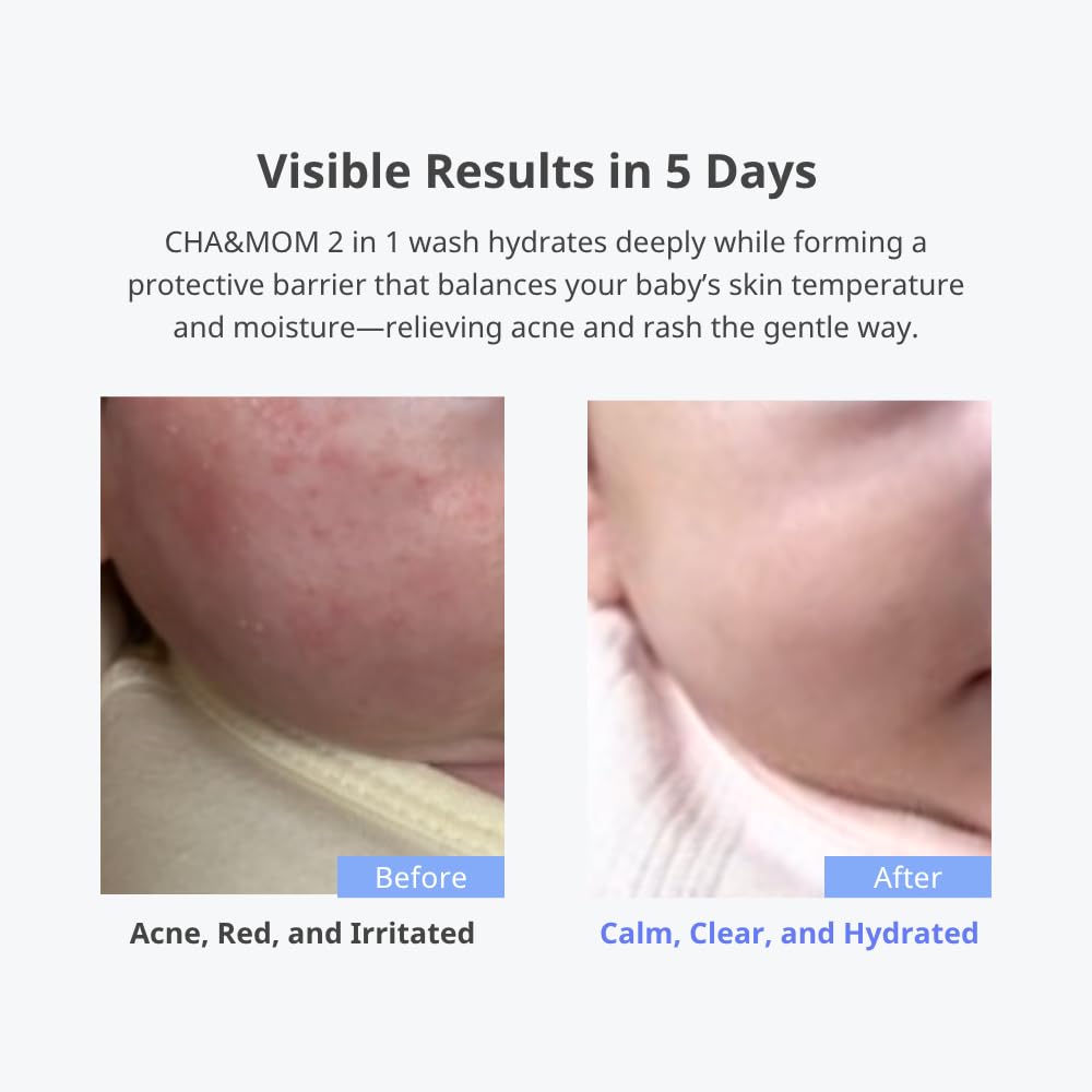 CHA&MOM Phyto Seline Hydro Hair & Body Wash, 10.58oz - Zezebaebae