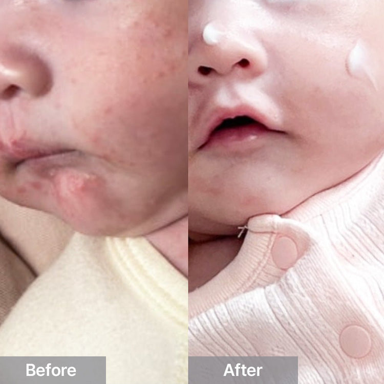 CHA&MOM Phyto Seline Moisture Lotion, 8.46oz - Zezebaebae